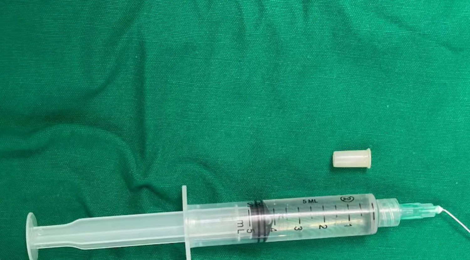 Niña de 3 años silbaba al reírse: había aspirado un silbato