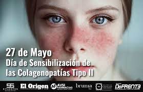 27 de mayo: Día de Sensibilización de las Colagenopatías Tipo II