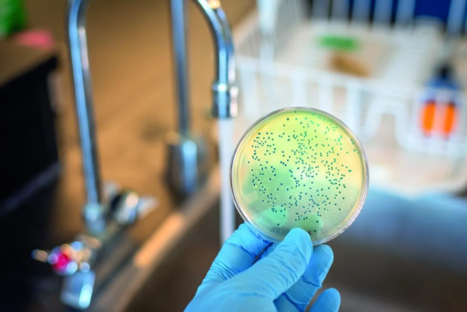 Infecciones por bacterias ponen en jaque el uso de antibióticos