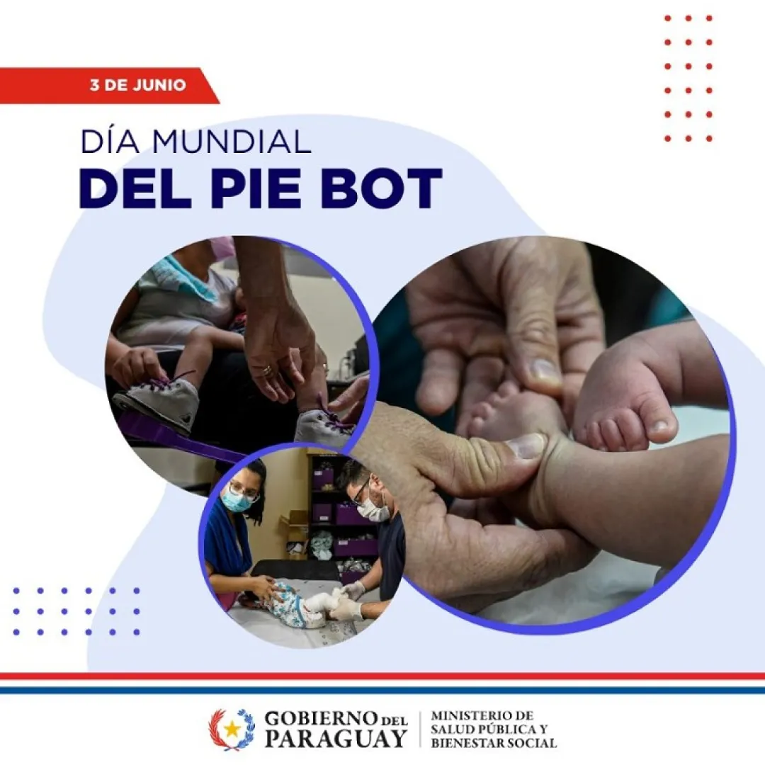 Hoy se recuerda el día Mundial del Pie Bot