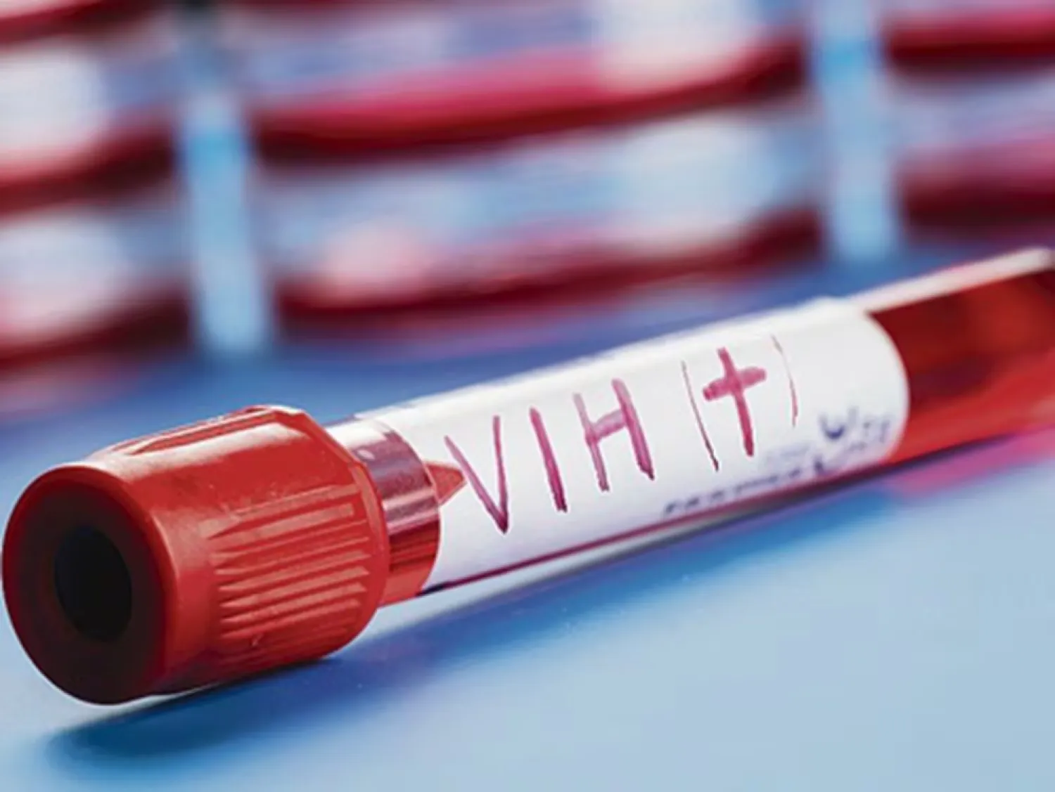 Diagnosticaron 1.350 nuevos casos de VIH/Sida este año