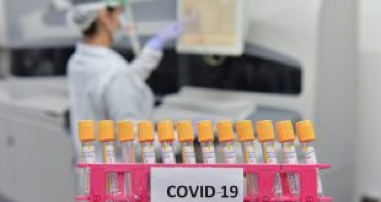 Rusia canceló todos los eventos públicos para frenar el avance del coronavirus