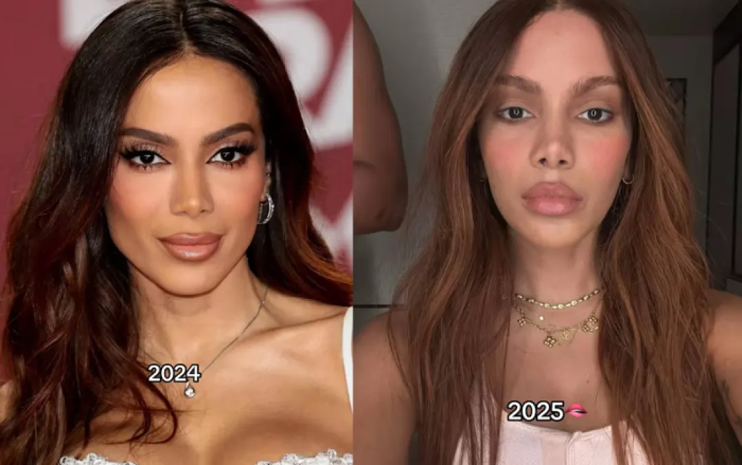 ¡Impactante cambio! Anitta reaparece con un nuevo rostro
