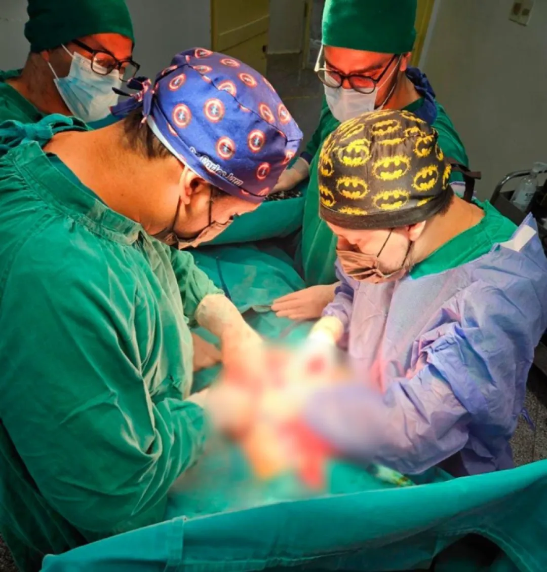Hospital Regional de Concepción: extirpan tumor de ovario de 10 kilos