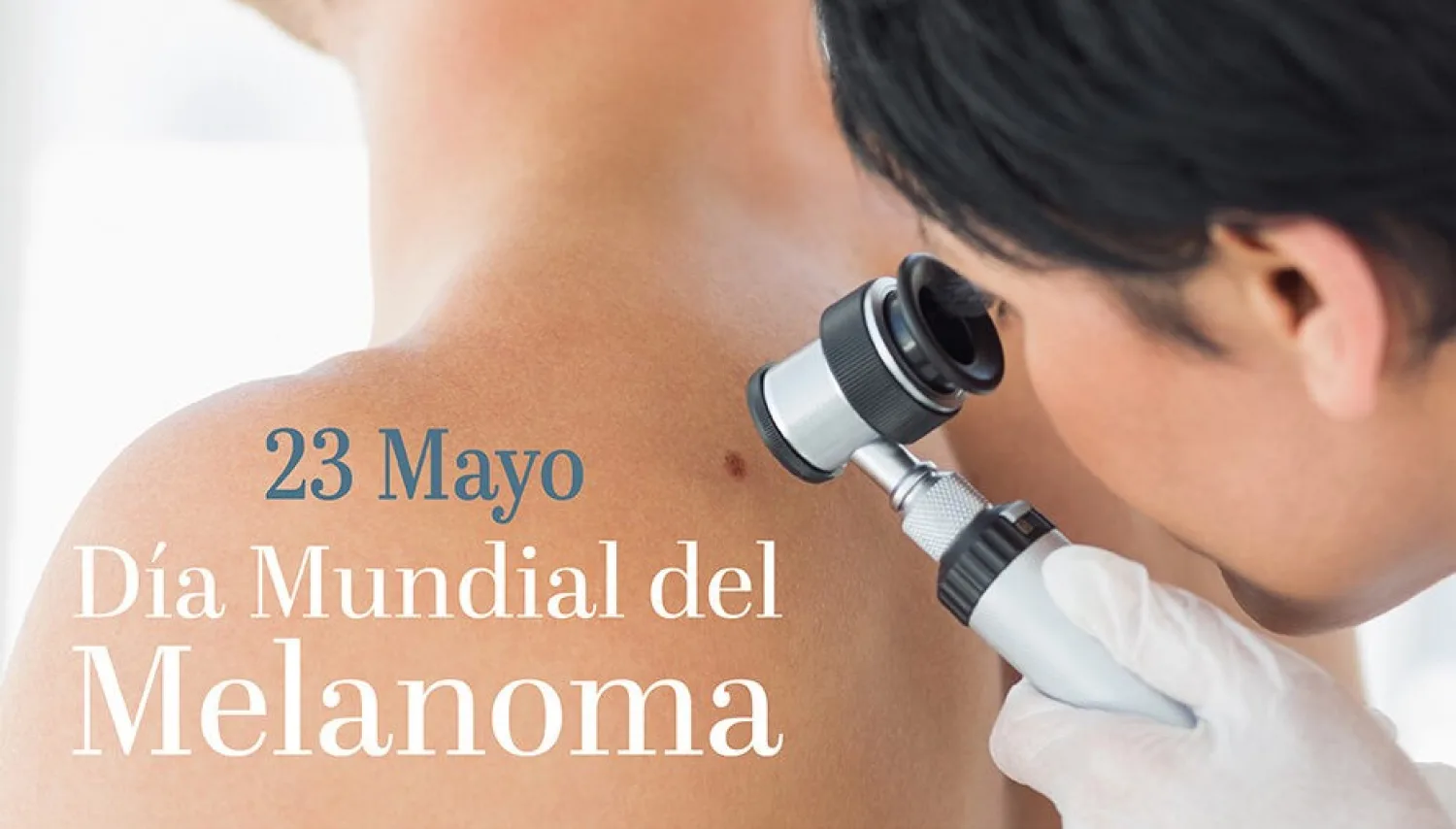 Este 23 recordamos el  Día Mundial contra el Melanoma