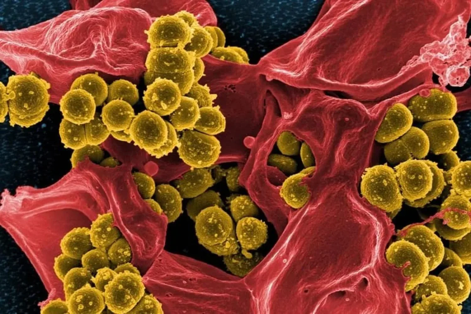 Alertan sobre la presencia de una superbacteria en el país