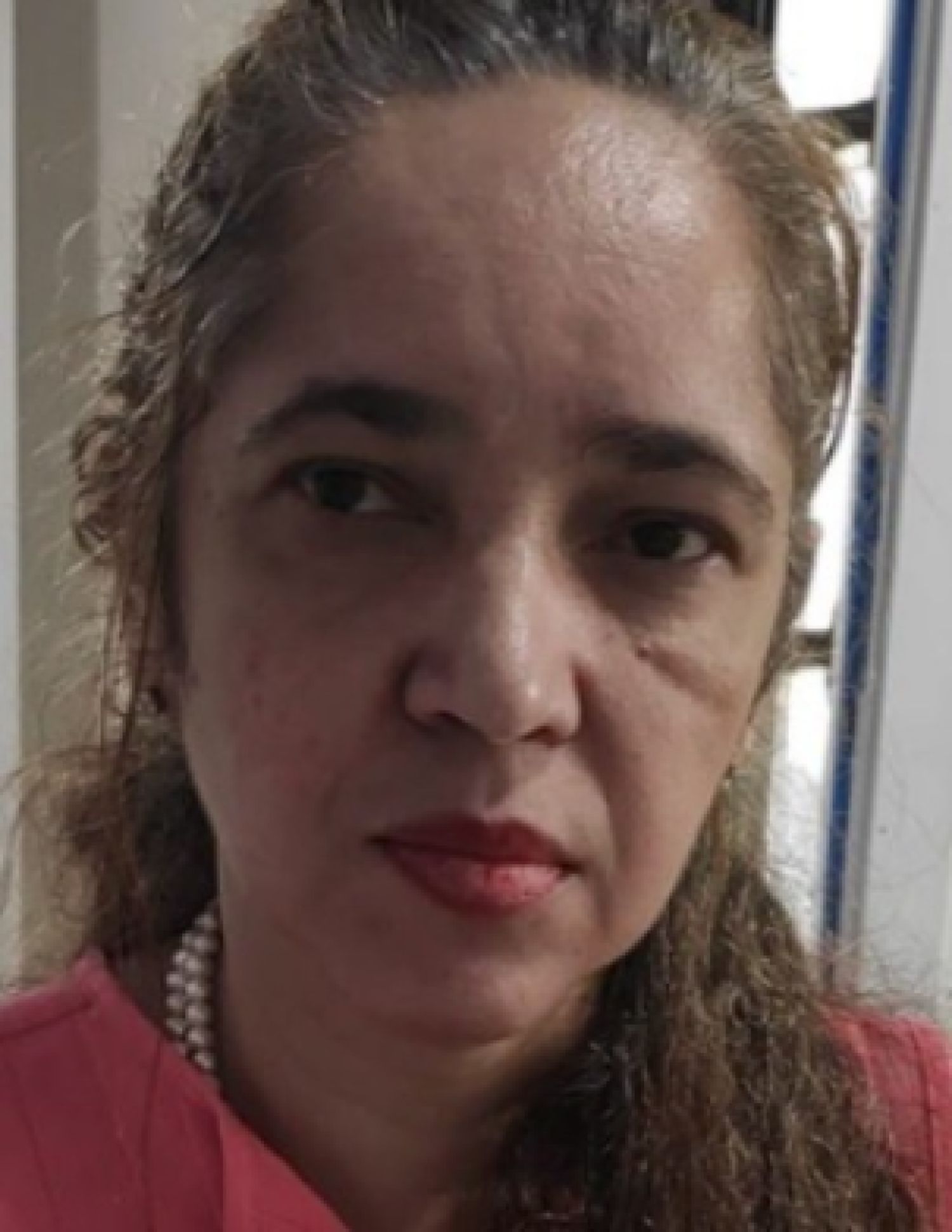 Enfermera atacada con mazo por su marido muere en Ponta Porã